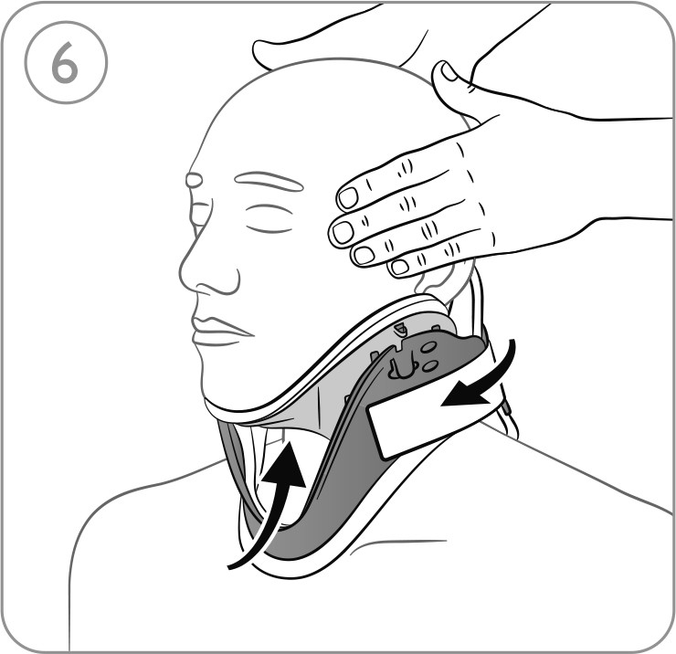 Instrucciones de uso collarín cervical Laerdal Stifneck Select - Paso 6